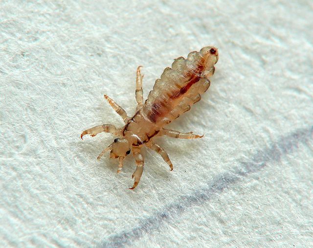 Close-up of head lice on strands of hair in Manenberg
